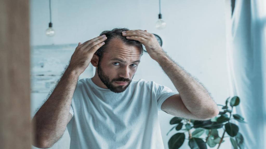 Hair Loss, middle aged man looking into a mirror separating his hair at the parting and inspecting his receding hair line | Tired All The Time? 6 Common Anaemia Symptoms | e-Surgery 