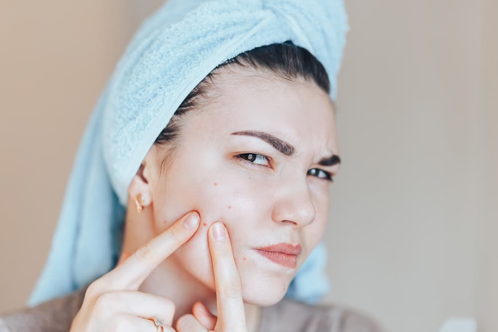 Young woman with towel warpped round head from shower, squeezing spot on face, acne in men