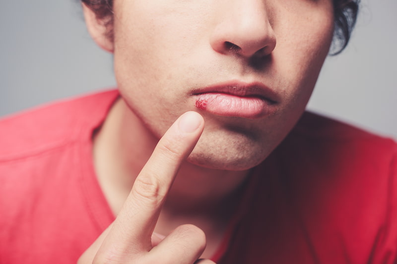 man wondering how to avoid cold sores in winter