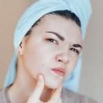 Does Acnecide Work? Results And Side Effects