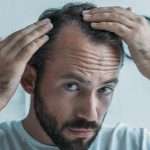Don’t Lose Your Hair! Can Home Remedies Treat Hair Loss?