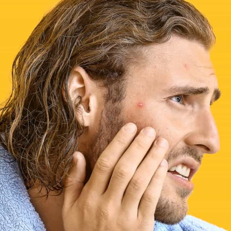 Man holding mirror looking at Acne spot, can lymecycline cause acne?