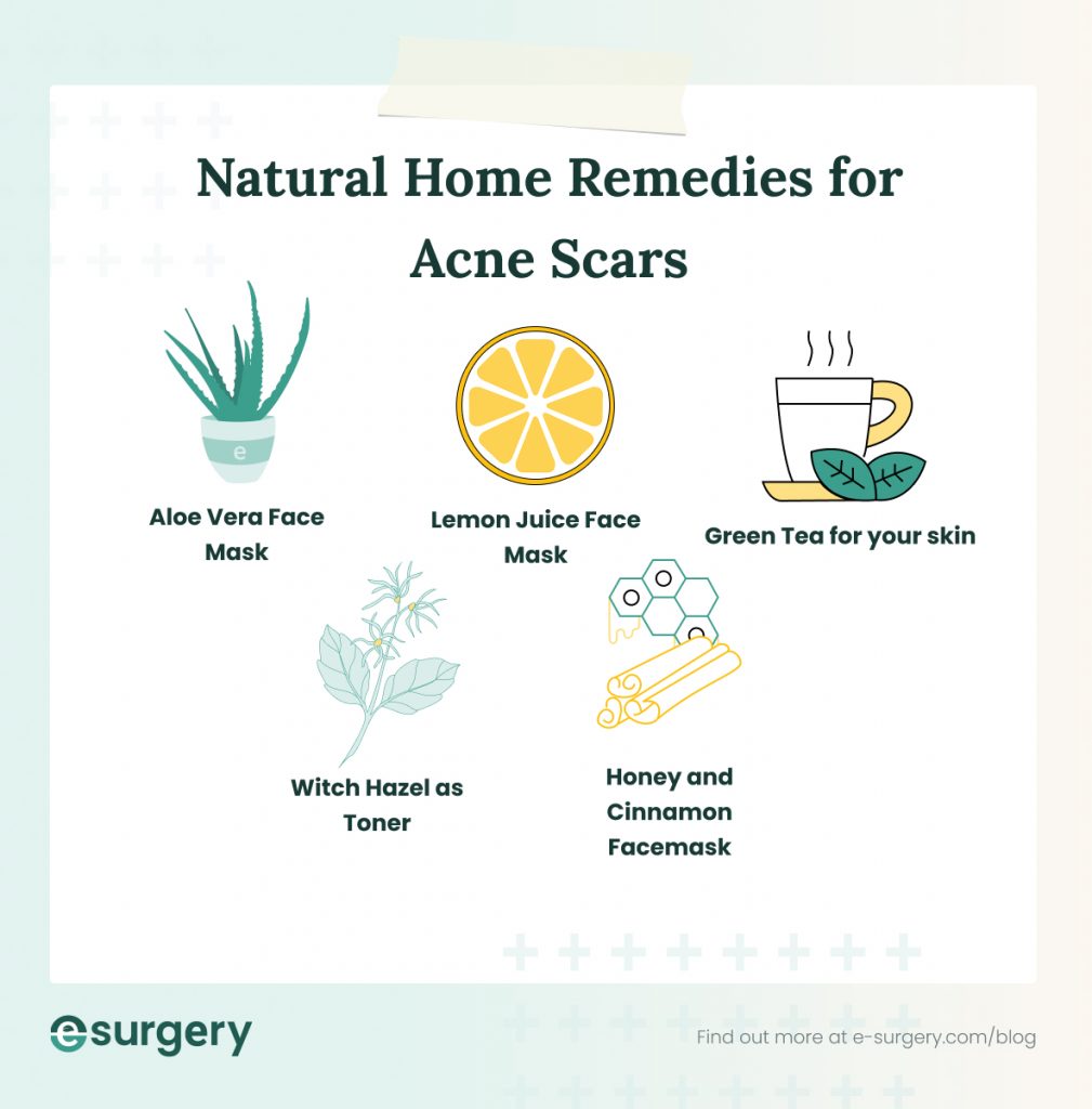 infographic to show 5 natural home remedies for acne scars | e-surgery