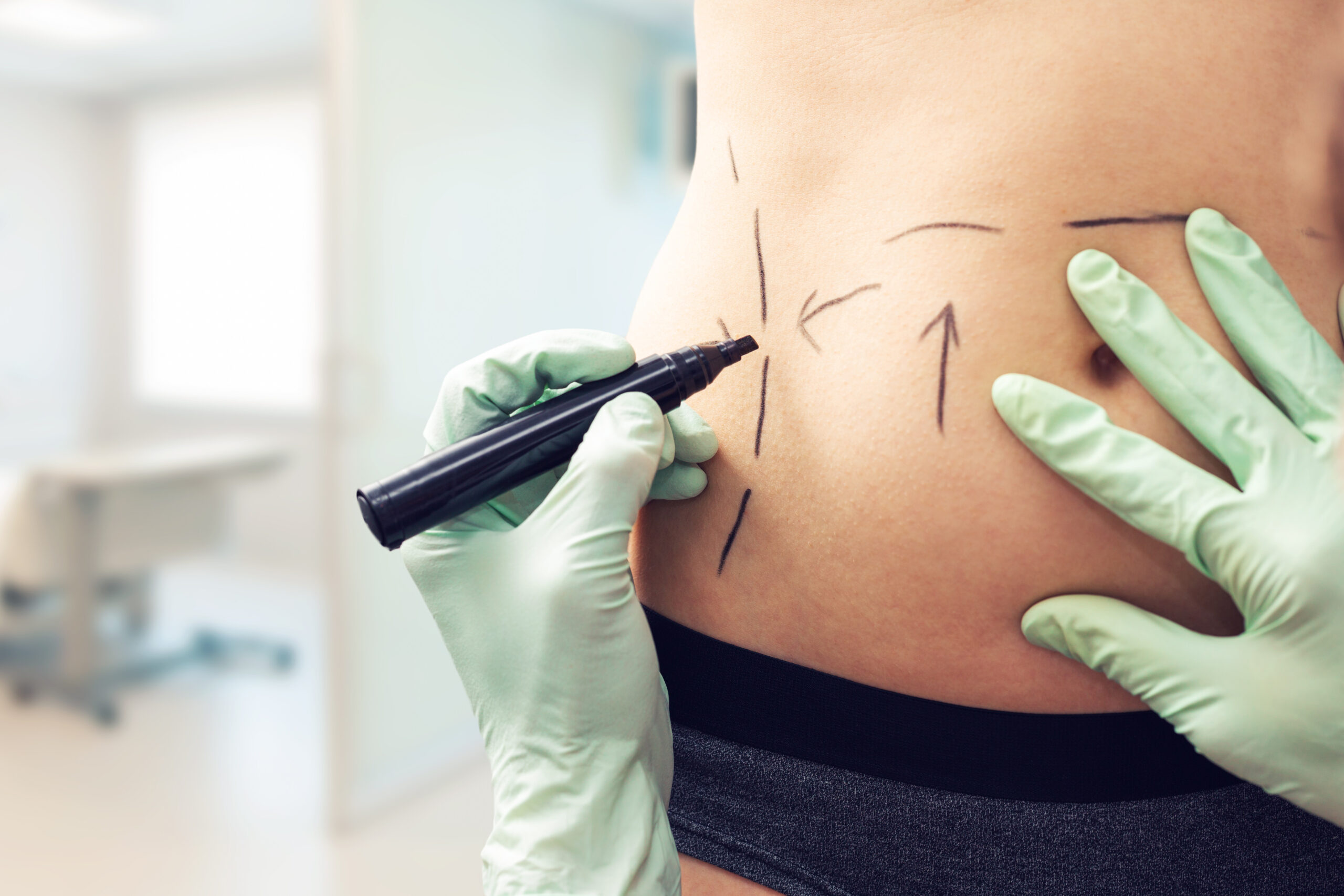 50 Gorgeous Tattoo Ideas to Cover a C-Section Scar | CafeMom.com