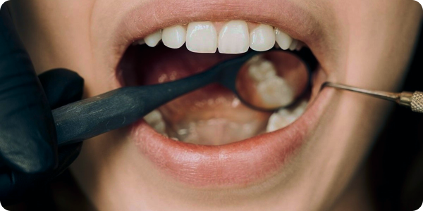 Eat for Your Teeth: How Nutrition Shapes Your Smile