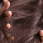 Why Hair Loss Happens During Rapid Weight Loss 