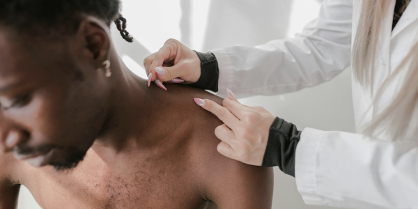 The ABCDEs of Melanoma_ How to Check Your Own Skin