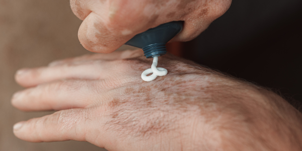 Treatment Options and What to Expect After Diagnosis