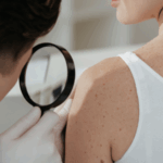 Sun, Skin & Staying Safe: What Skin Cancer Awareness Month Wants You to Know 